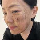 뉴필링