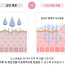 앤투비