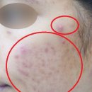 하나로누가약국 | 약국 EGF 재생크림 직접 사용해 본 후기