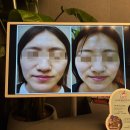 김포에스테틱 어디가 좋아요? 시설·실력·결과 완벽 바얀스파