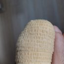 순정병원 | 순천 내성발톱 수술 잘하는 곳 순정병원 수술 후기