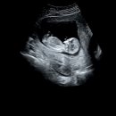 가연관악산부인과의원 이미지