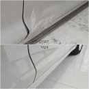 허덴트 이미지