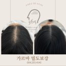 P-7717 | 포항두피문신 하고 자신감 뿜뿜 진작할껄 !