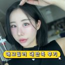 최애멍 | 애교필러 후기 내돈내산 (통증, 멍, 붓기)