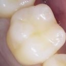 송탄바른치과의원 이미지