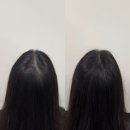 도트바이림 | 대전두피문신 : 도트바이림에서⋆ ₊ ﾟ ☽ *내돈내산 후기!