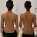 인동사거리 | [구미 인동 웨딩관리]젠에스테틱_거북목,말린어깨 관리후기