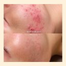 블랑드스킨 이미지