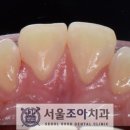 서울조아치과 이미지