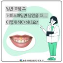 스마일치과의원 이미지
