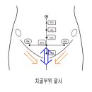 힐링쑥뜸 네이버블로그