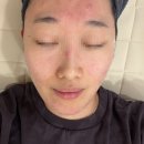 애몽 | [수지 피부관리] 애몽스킨케어 트러블 케어 후기｜피부과 15년 경력 원장님✨