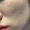 대치예스약국 | [피부 관리] 함익병 피부과 3차 방문 후기(피부사진 有)