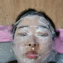 남악하나내과의원 | 남악 편평사마귀 제거 내돈내산 후기: 남악 고운의원(사진주의)