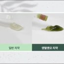 오-덴탈 이미지