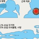 체내수분량이 부족할 때 탈수증상 알아보기 이미지