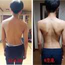 일반인이 본 침술이야기_홈침은 이기적인 침술이다