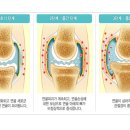 본튼튼마취통증의학과의원 네이버블로그