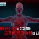 이런 습관 못 버리면 뇌 손상될 수도 이미지