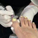 송탄베스트의원 | 평택 내성발톱 전문점 - 송탄베스트의원 발관리센터 (실비보험 가능)