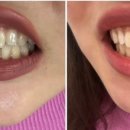 덴탈스파치과의원 이미지