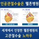 고관절,고관절통증,고관절수술,고관절인공관절,관절내시경,대퇴골두무혈성괴사 이미지