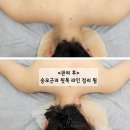 수원-1459 | 수원역포레스트에스테틱 융복합 에너지테라피 비대칭 교정 후기