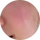 숨 피부관리 | 구로디지털단지 피부관리 숨스킨 피부관리 후기