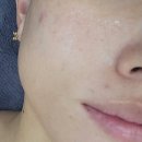 사임당로18길 58 (1) | [부티난다]구미봉곡동피부관리 구미에스테틱 구미피부관리샵 봉곡동에스테틱 부티난다 솔직후기