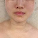 마곡윤곽관리 여름아이 뷰티끄 신부 관리 후기 1회만에 이렇게?