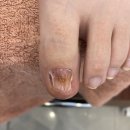 도도스네일 | 일산무좀발톱 도도스네일 관리 잘하네요