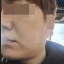 바우스 | 바우스 온다리프팅 후기｜초음파 진단 + 시술까지 받아본 리얼후기