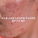 보람한의원 | 리유한의원 가격 아깝지 않게 처음으로 효과 본 후기