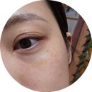 어버이날 선물 피디알엔 리들샷 아이리프터 홈쇼핑 진동아이크림 추천