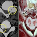 목 디스크 수술센터- 증상 진단 치료방법 이미지