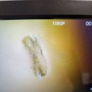 소리보청기 | 리사운드보청기 수리 후 소리 차이 확 느낀 후기