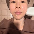 청담동피부과 이마 눈썹리프팅 통증없는 소프웨이브 내돈내산 후기