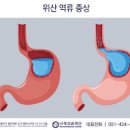 잦은 트림 원인 (속트름, 헛트름) 해결 방법 이미지