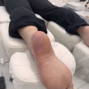 레푸스&아트포레 이미지