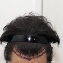 뉴헤어모발성형외과의원 이미지