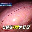 살빼야