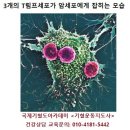 대장암 초기증상 이미지