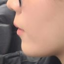 [스플린트 기록 마지막/악궁확장 시작] 병점하이치과의원 B-스플린트 2주 후기/악궁확장 시작