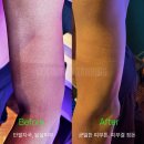 하얀피부미용도;소매 | 동탄태닝 | 골프 후 팔만 하얗다면? 반팔라인 복구 후기