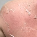 천안 RPC 이미지