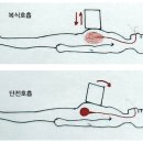 단전호흡 이미지