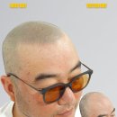 모델헤어라인 이미지