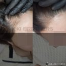 리더 헤어라인