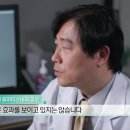 류마티스 질환과 싸우는 청춘 특집 1편 루푸스 이미지